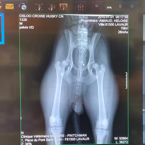 Radiographie du bassin